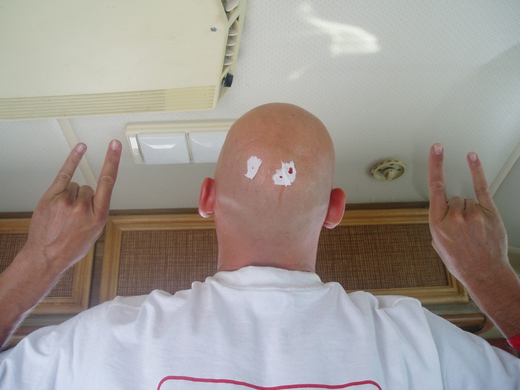 Mojo shaves his head. Ouch.